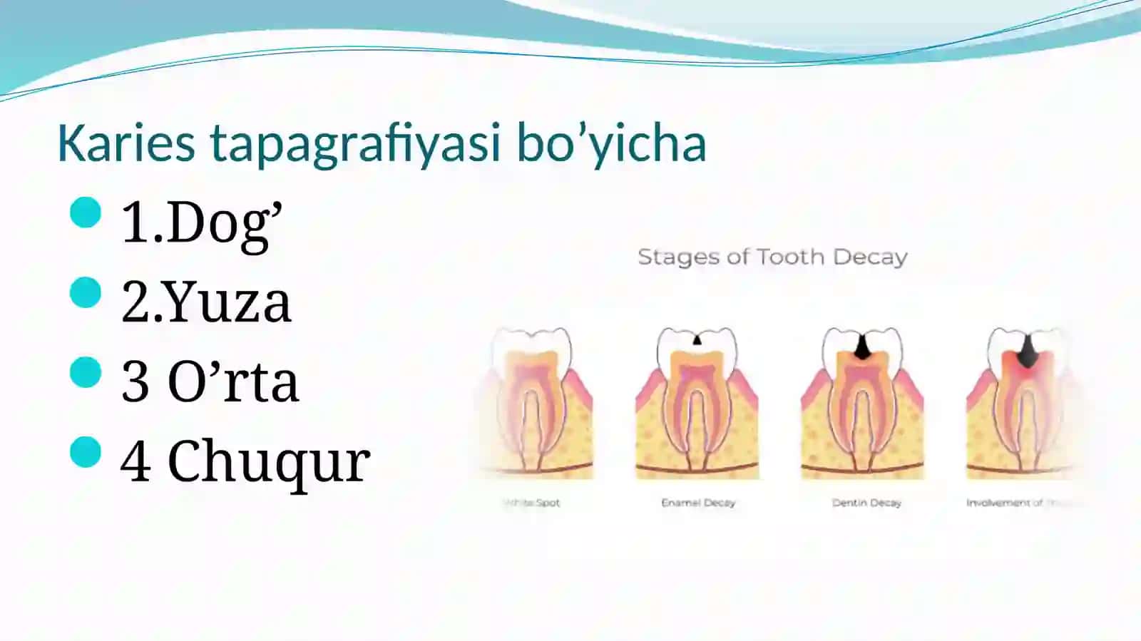 Karies kasalligini davolash 4