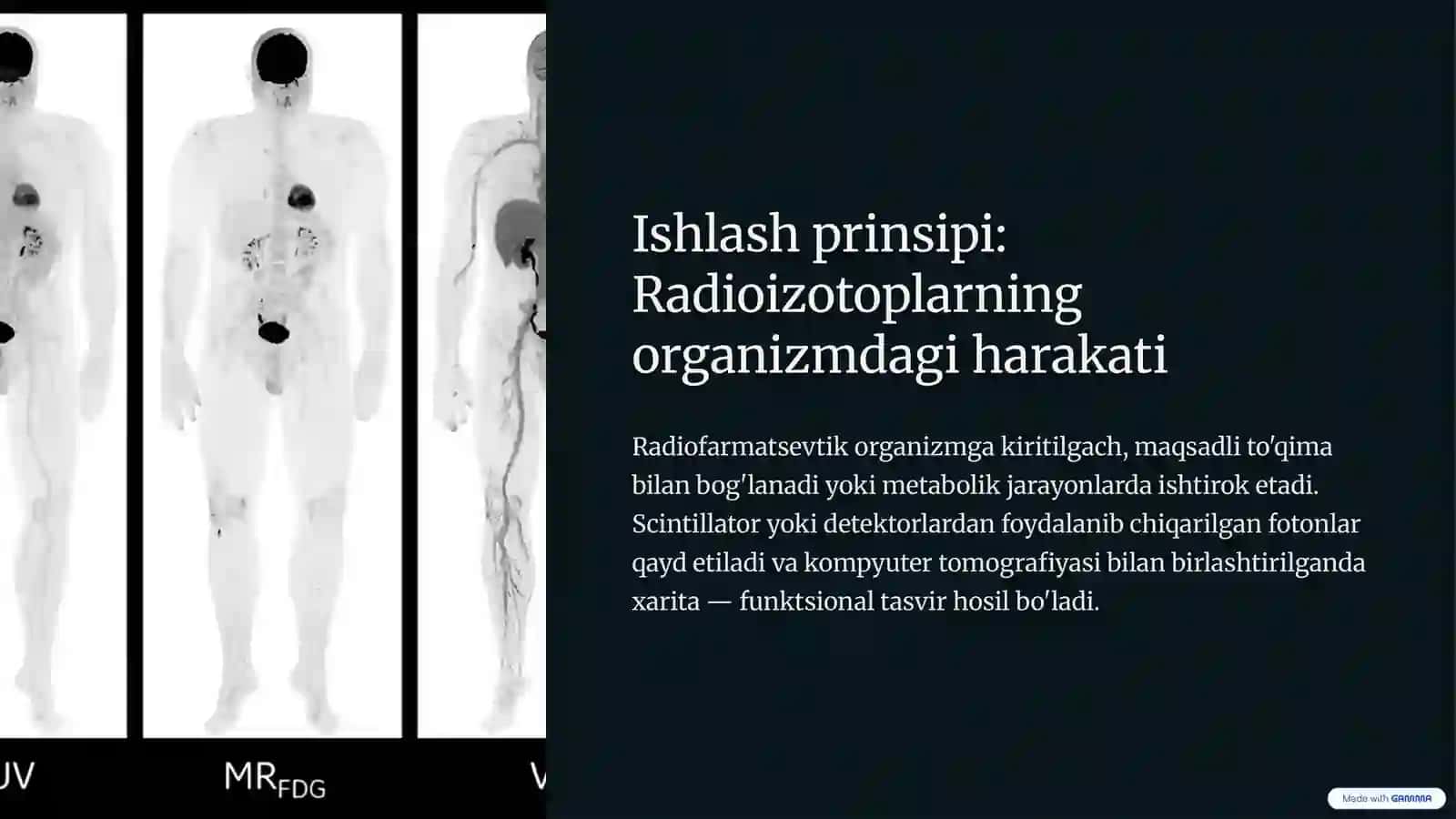 Radionukleid tekshirish usullari: Zamonaviy tibbiyotdagi o'rni 4
