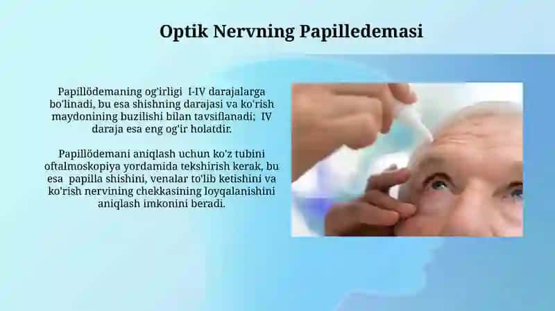 Optik Nervning O'smalari 4