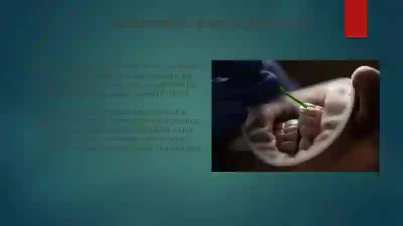 Endovaskulyar operatsiyalar 4