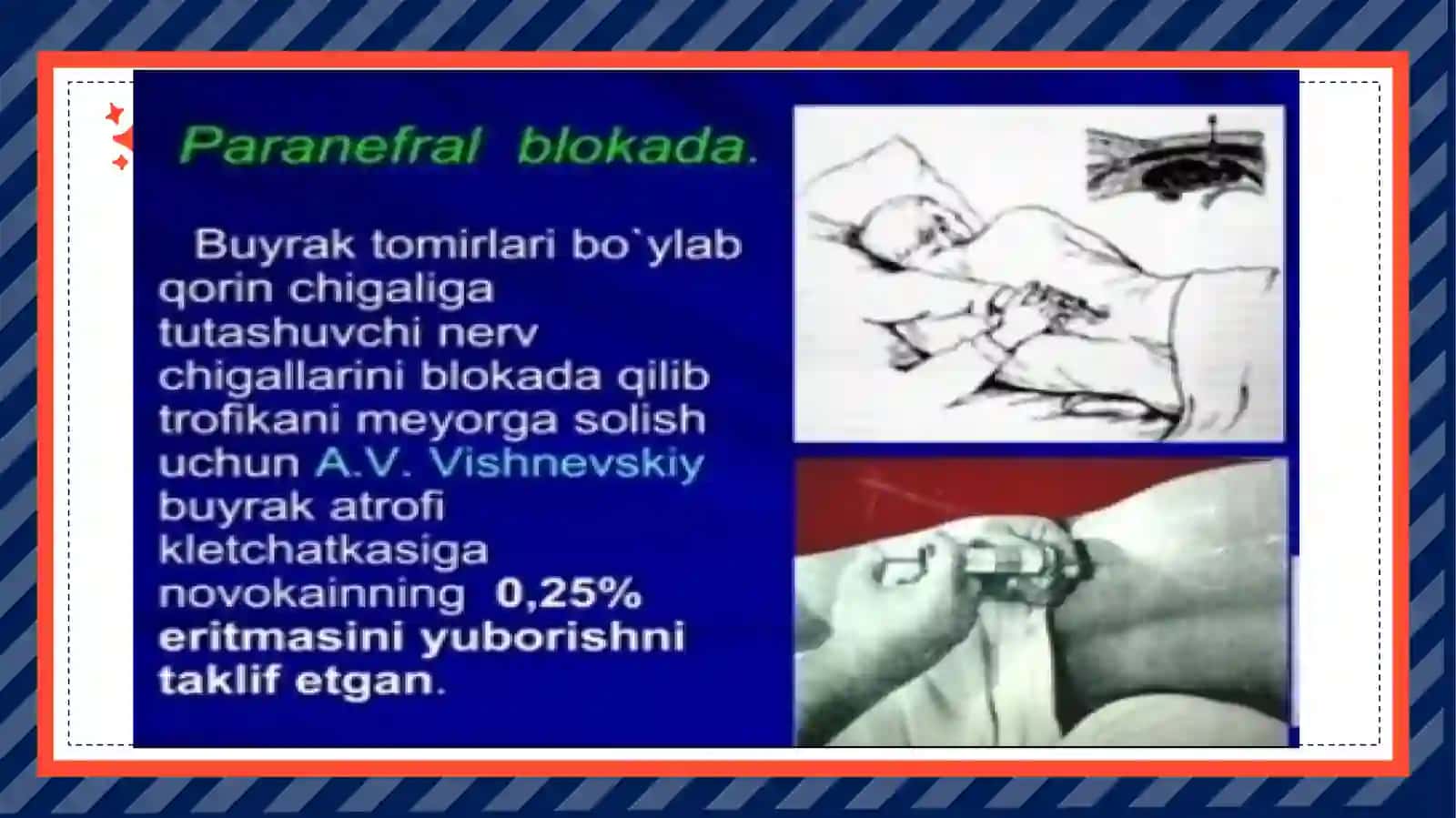 Belsohasidagi operatsiyalar 4