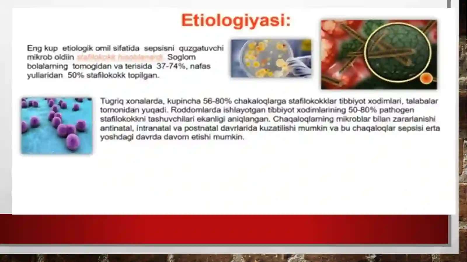 sepsis kasalligi 4