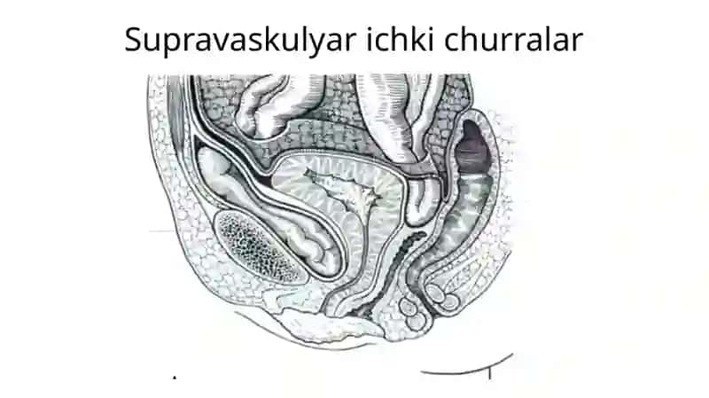 Ichki churralar 4