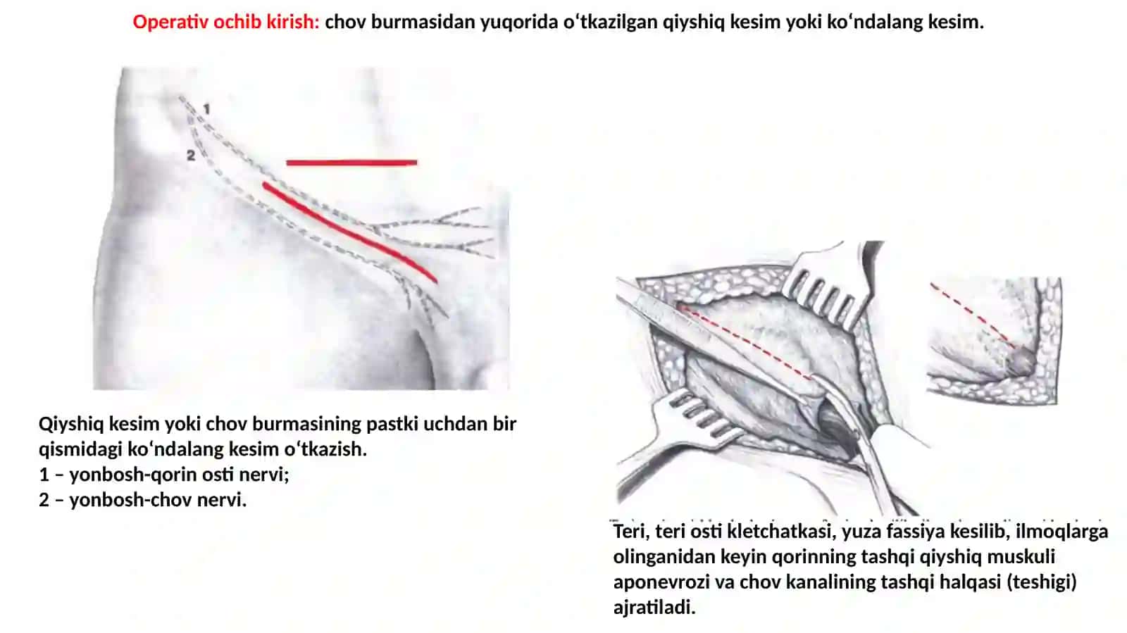 CHURRA KESISH TEXNIKASI 4
