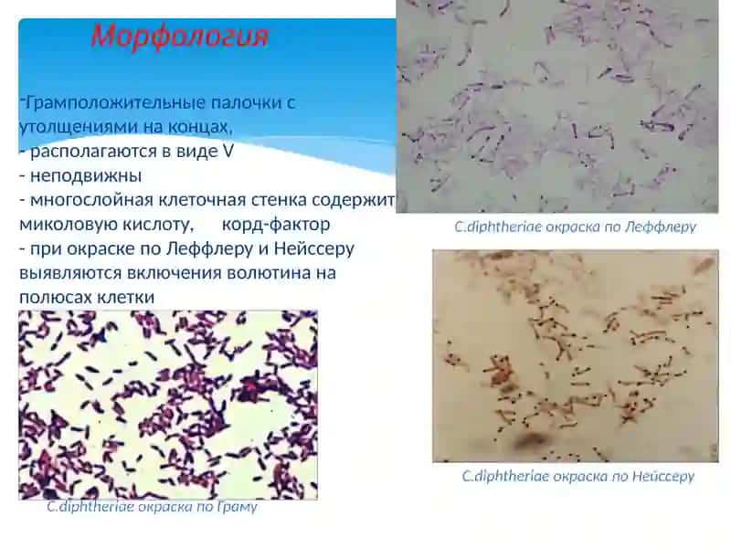 ДИФТЕРИЯ 4