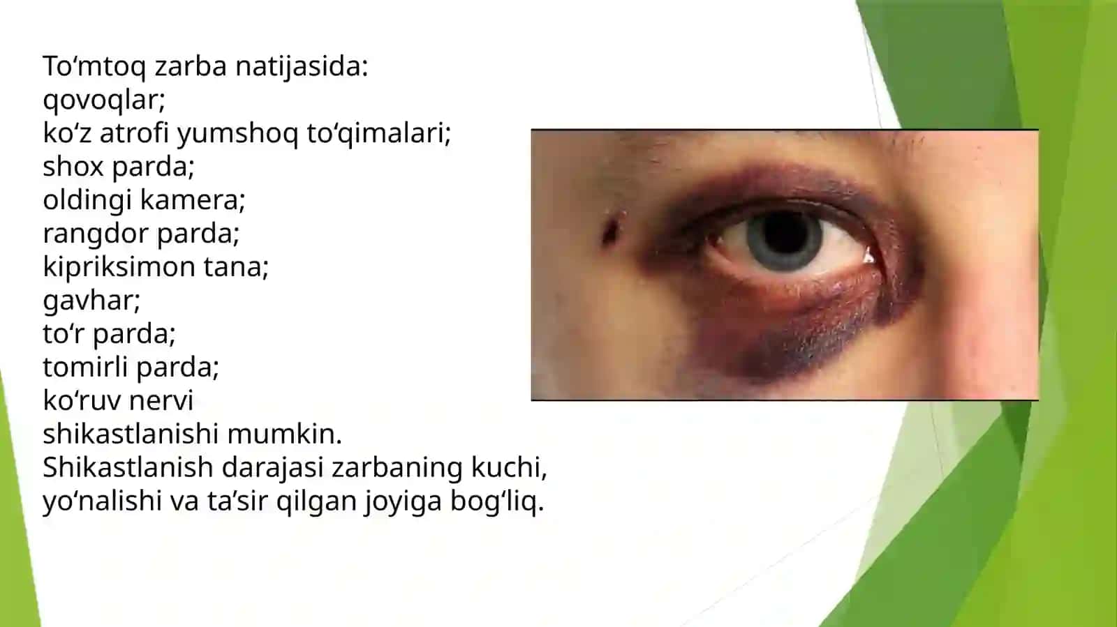 Ko’zkontuziyalari 4