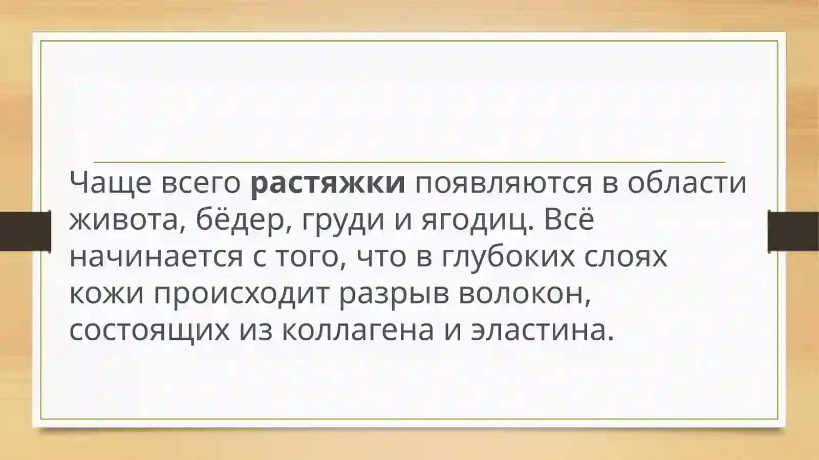Растяжки 4