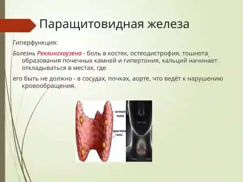 Эндокринной болезни 4