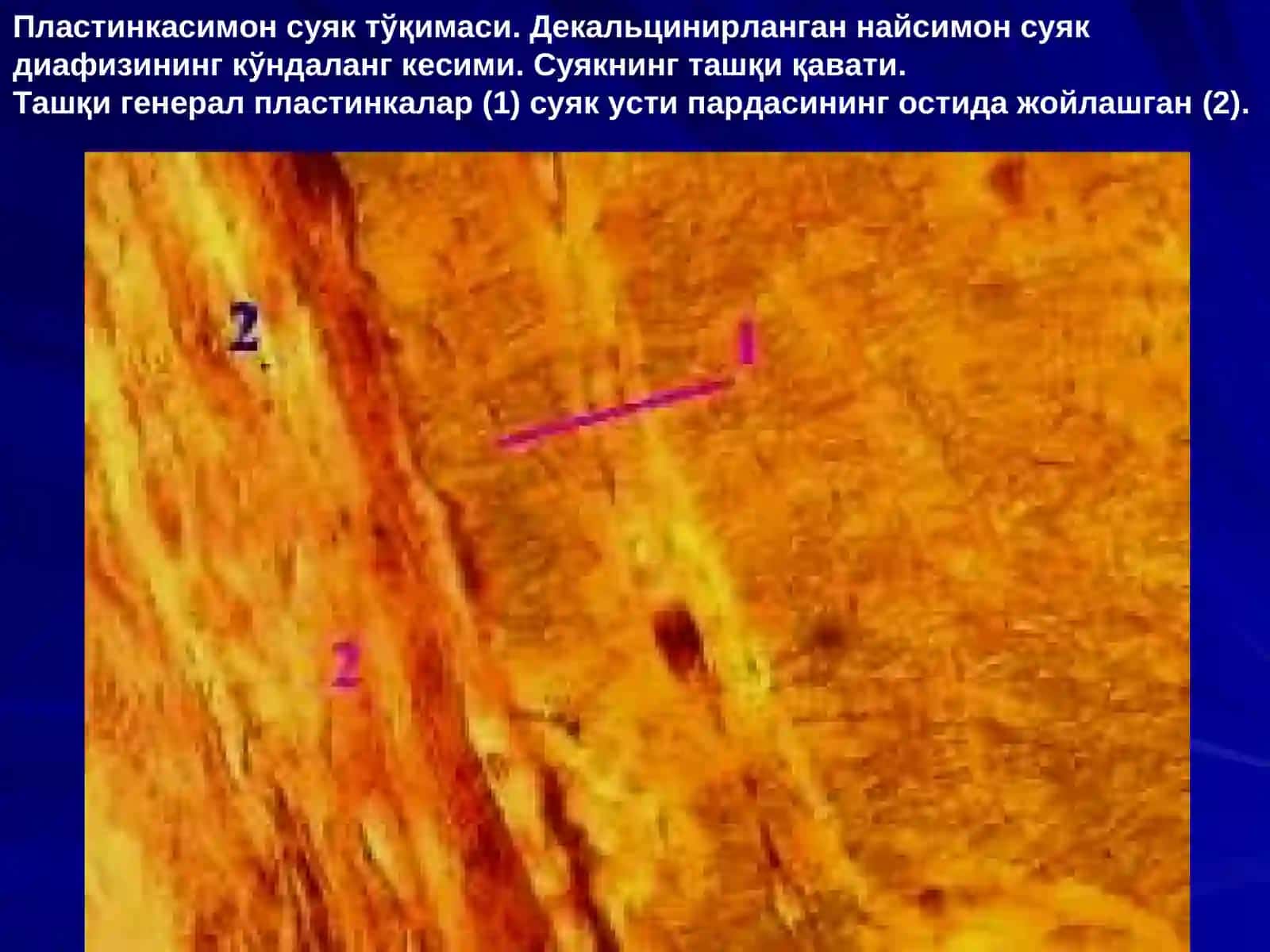 СУЯК ТЎҚИМА 4