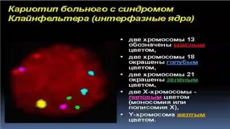 Генетические заболевания с умственной осталостью 4