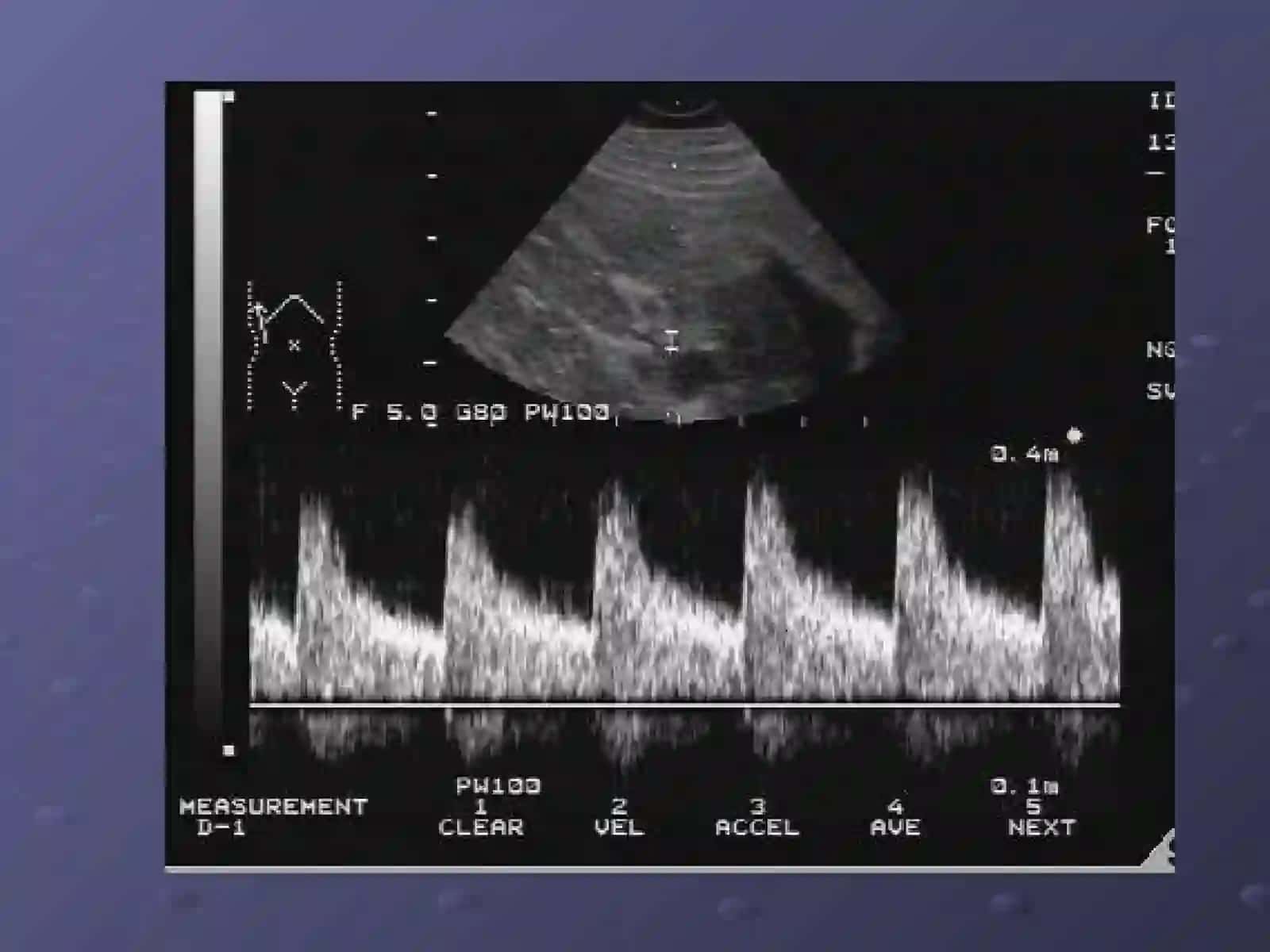 Buyrak va Siydik Yollari nur tashxisi Radiologiya 4