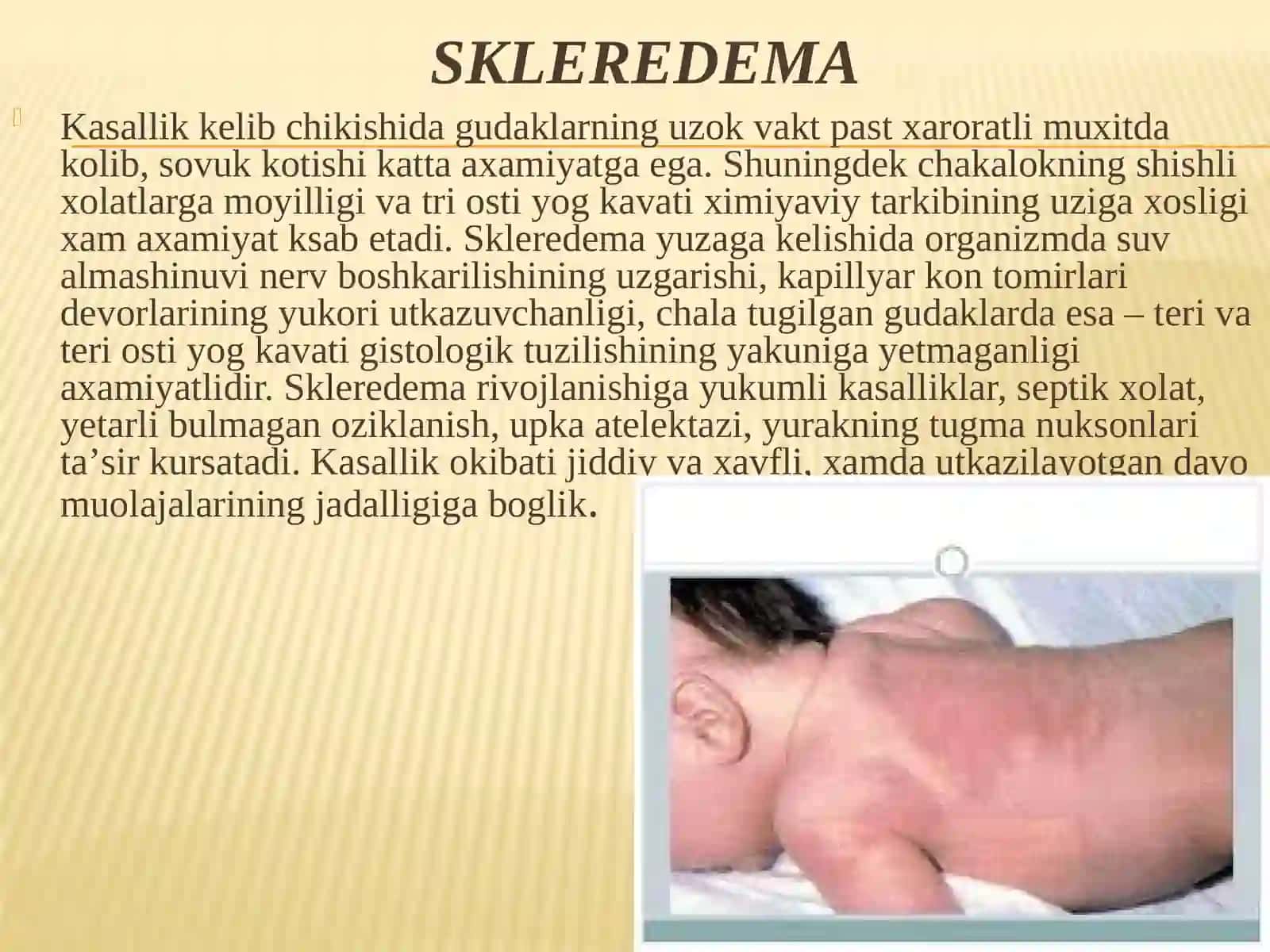 Yangi tug’ilgan chaqaloqlarning teri kasalliklari 4