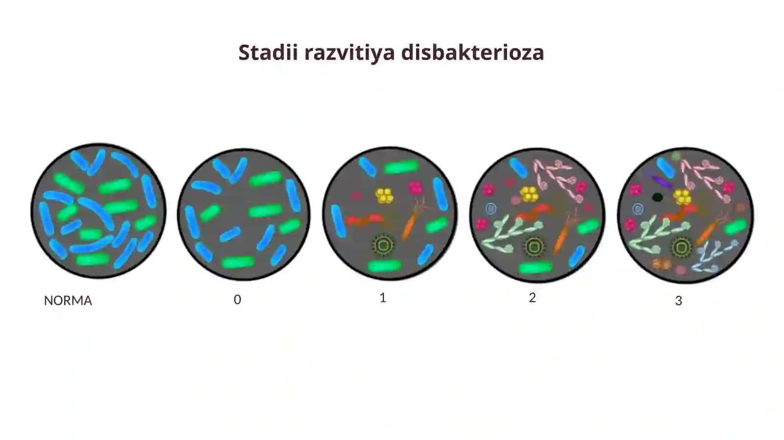 Ichak disbakteriozi etiologiyasi va diagnostikasi (2-variant) 4