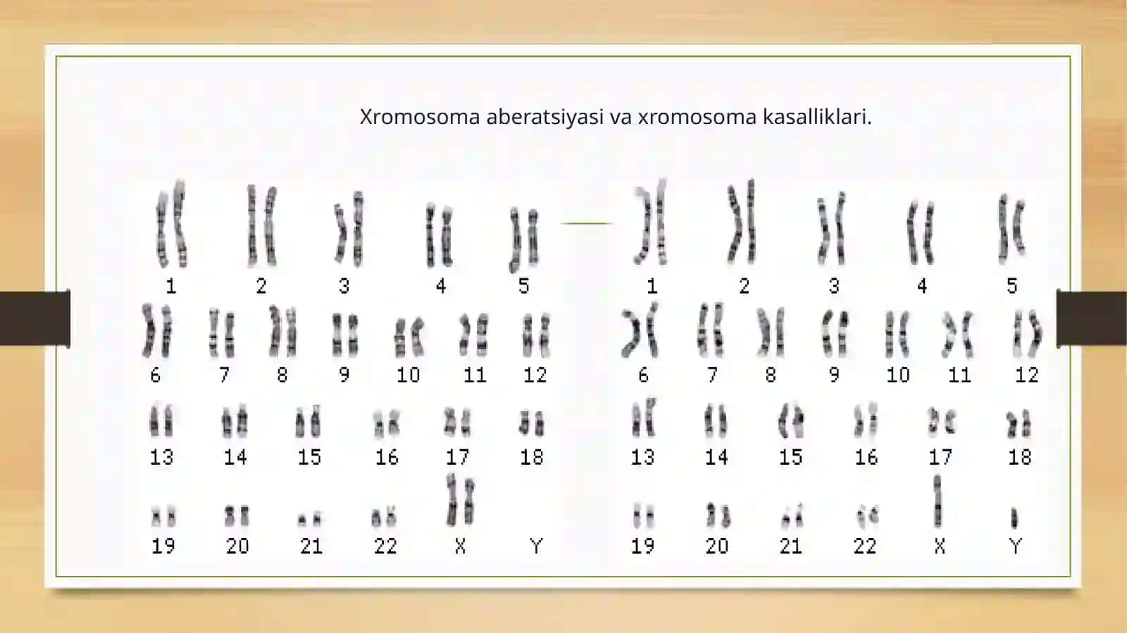 Xromosoma abberatsiyalari yoki qayta tuzilishlari 4