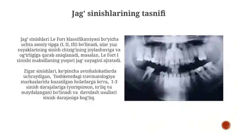 Tish va yuz jag‘ suyaklarini shikaslanishlari va sinishlari 4