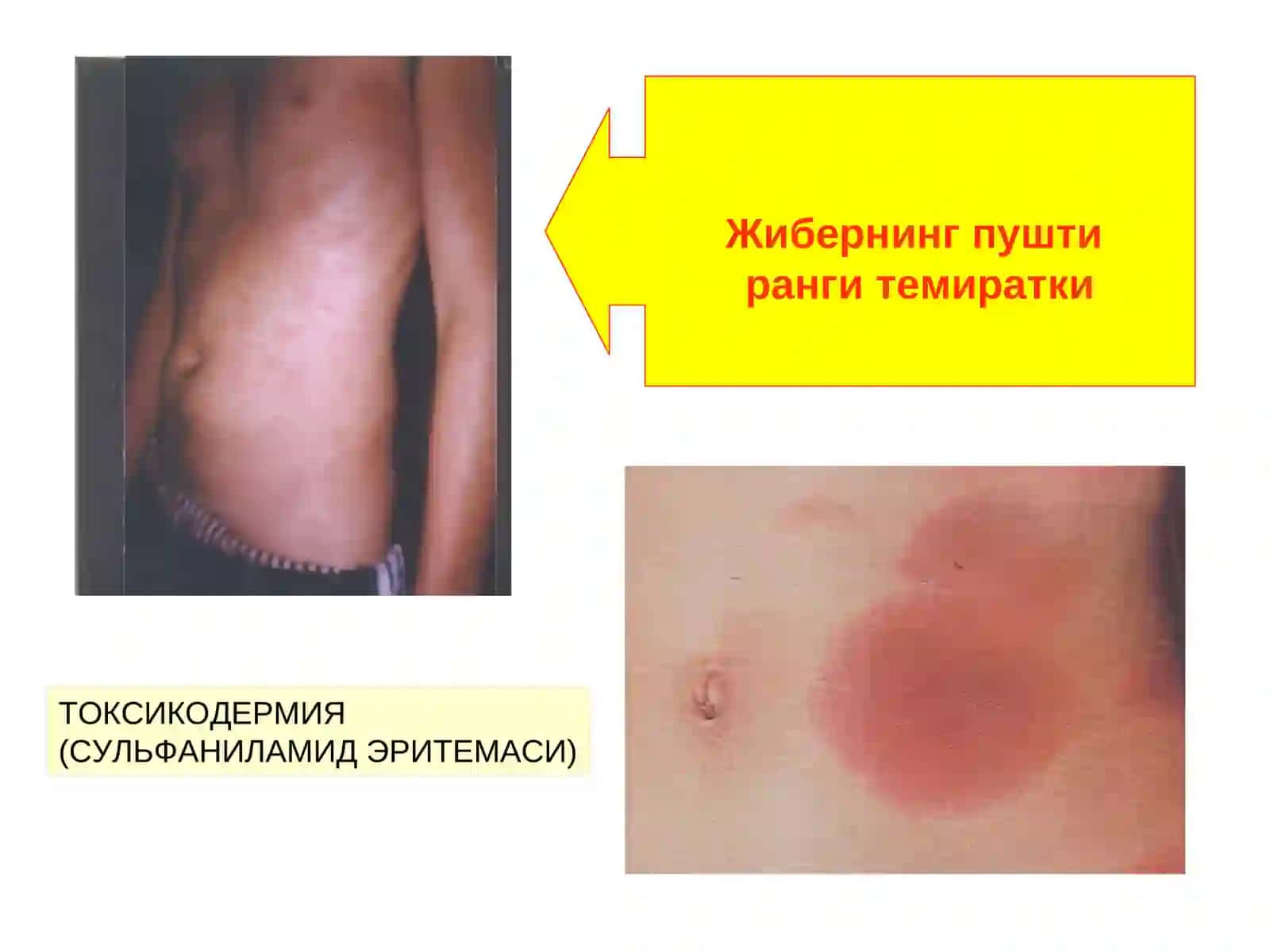 Доғ (macula) 4