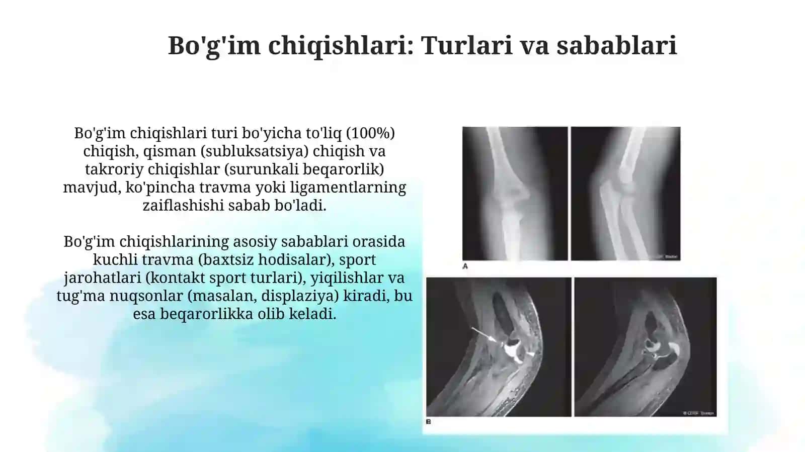 Suyaklar sinishi va boʻgʻimlar chiqishi.Transport immobilizatsiyatsiyasi.Yatrogeniya 4
