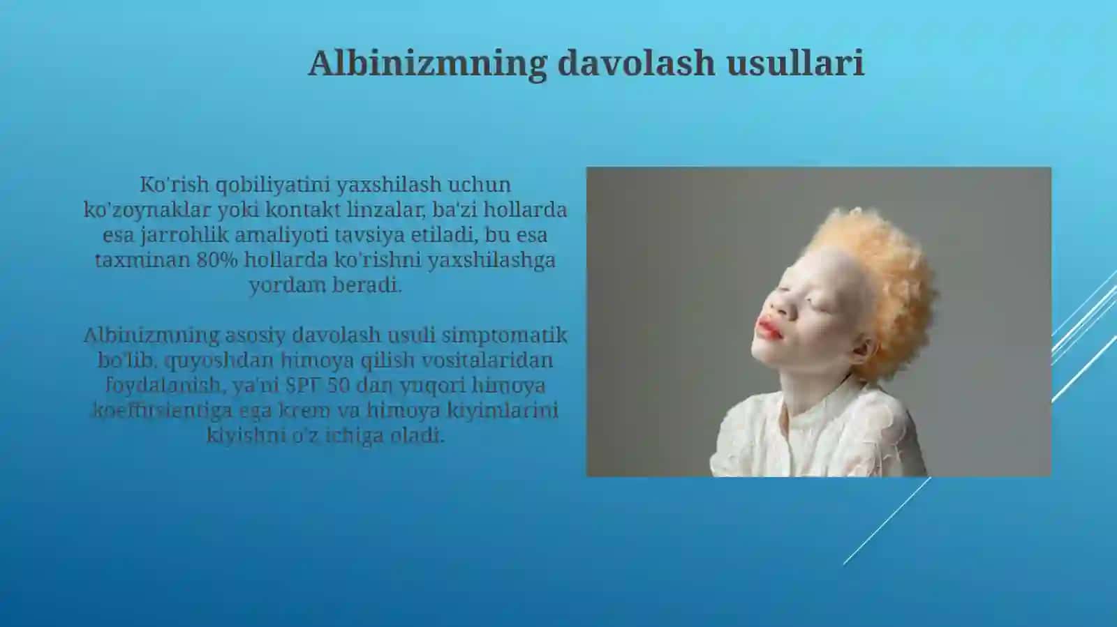 Albinizm 4