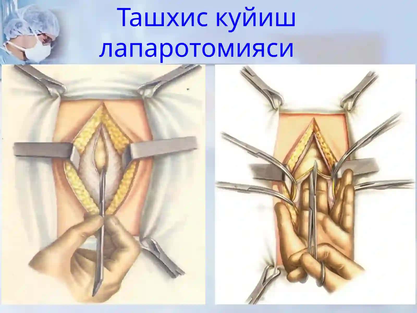 Хирургик операциялар 4