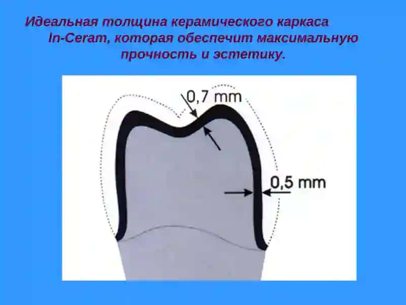CAD/CAM технологии Cerec inLab 4