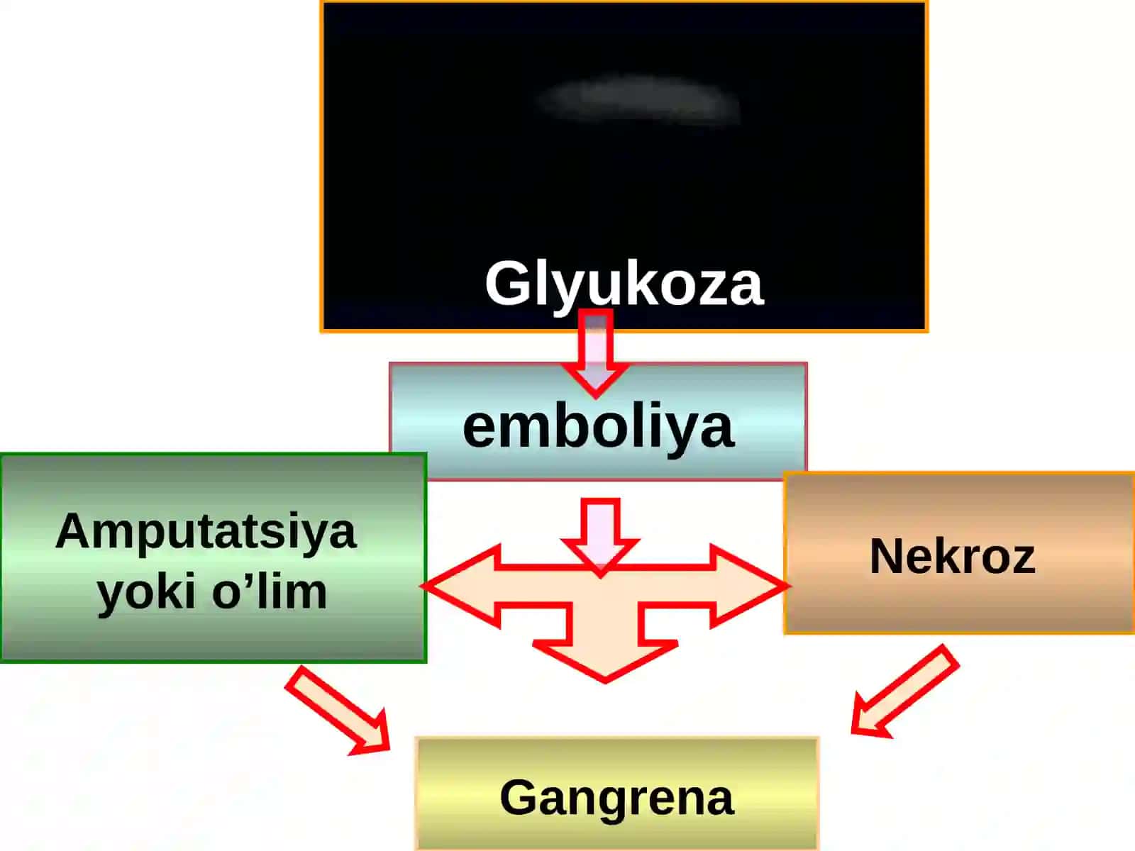 Қандли диабет 4