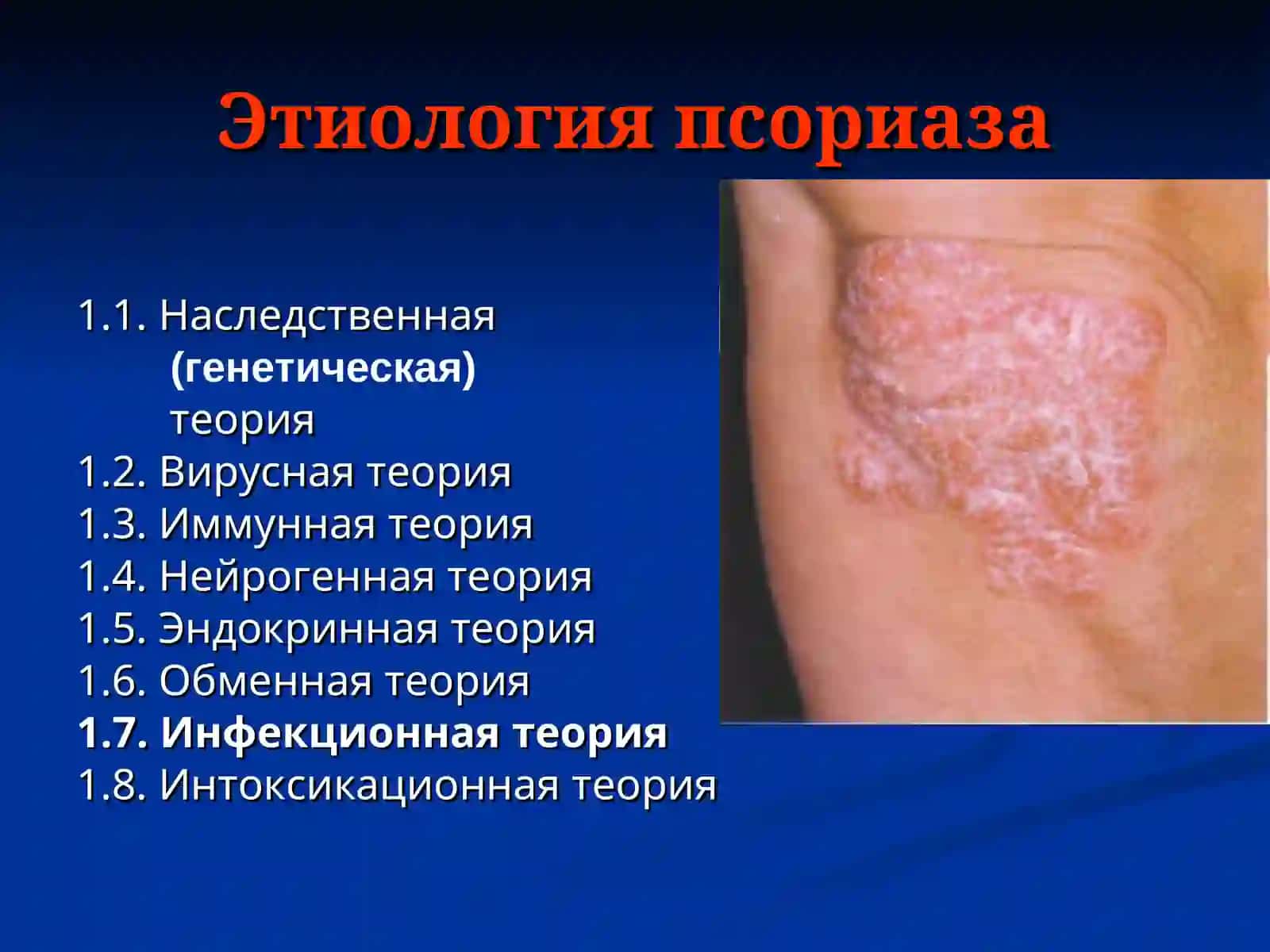 ПСОРИАЗ, КРАСНЫЙ ПЛОСКИЙ ЛИШАЙ, ПРЕДРАКОВЫЕ ЗАБОЛЕВАНИЯ ГУБ И СЛИЗИСТОЙ ОБОЛОЧКИ 4