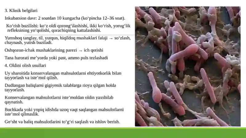 ovqatdan zaharlanish 4