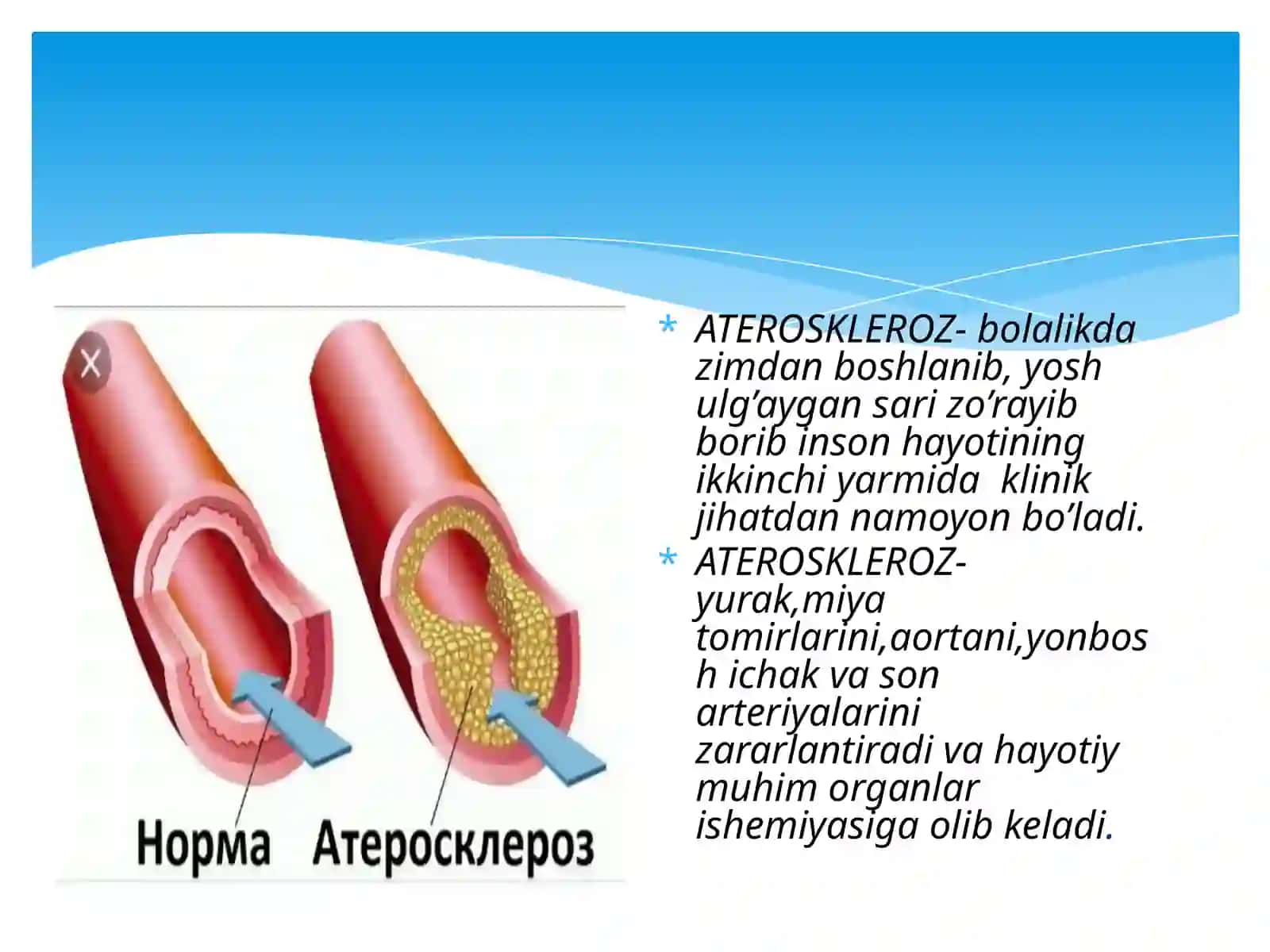 ПАТОЛОГИК АНАТОМИЯ “ИММУНОПАТОЛОГИК ЖАРАЁНЛАР” TOMIR KASALLIKLARI - ATEROSKLEROZ. GIPERTONIYA 4