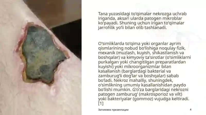 Nekroz. Nekroz va Apoptozning Farqi 4