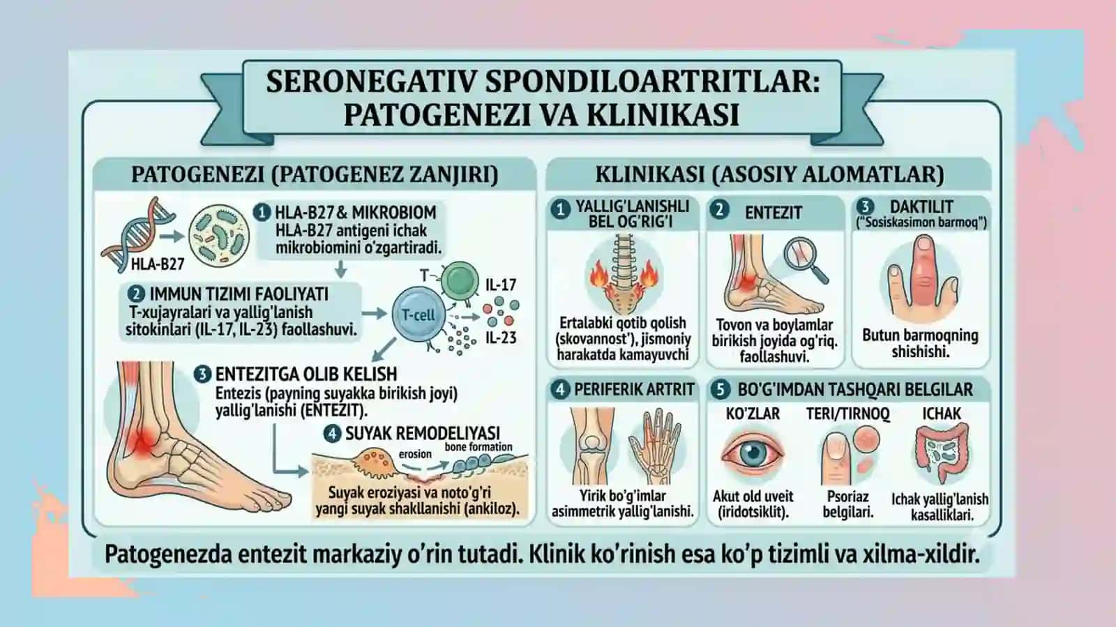 Seronegativ spondiloartritlar 4