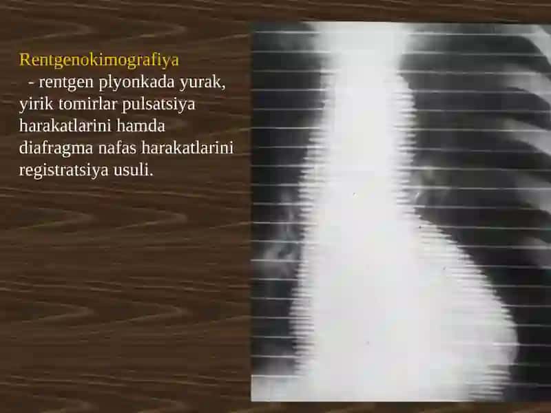 YURAK QON-TOMIR TIZIMI KASALLIKLARI 4