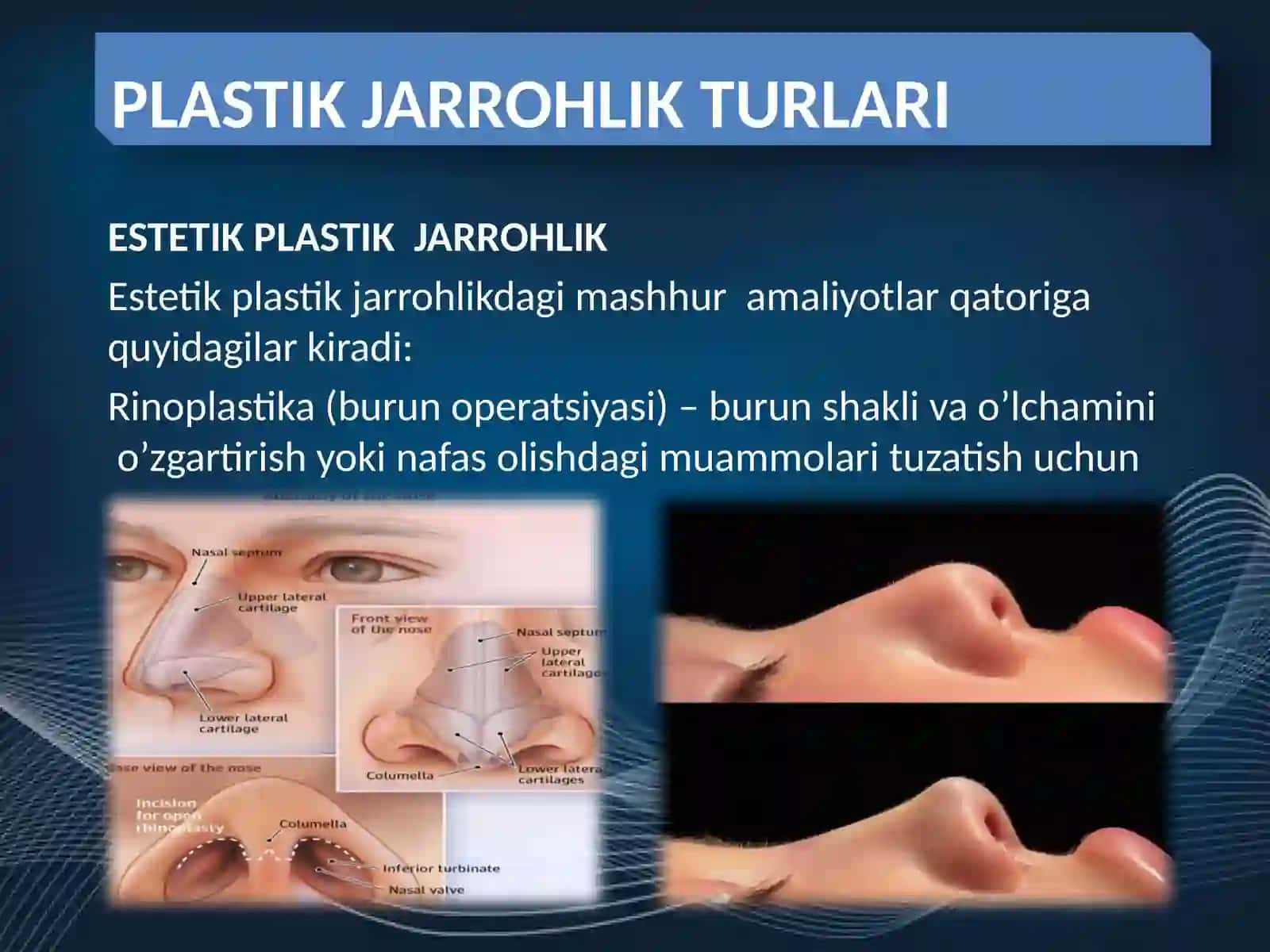 Plastik jarrohlik 4