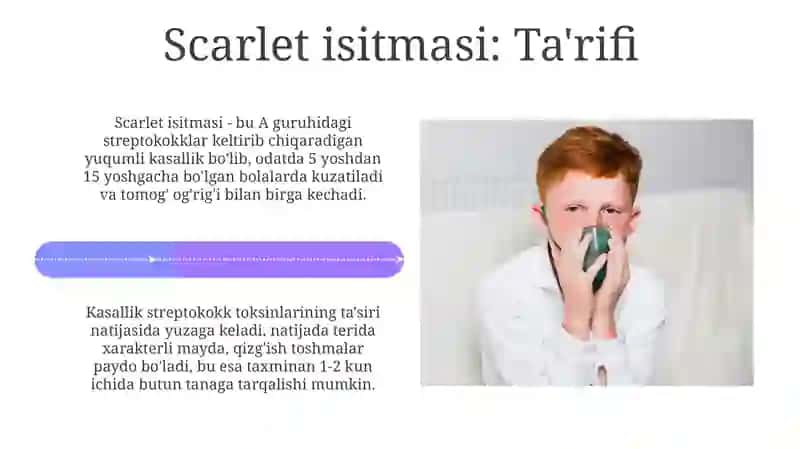 Skarlatina va Suv chechak kasalliklari 4