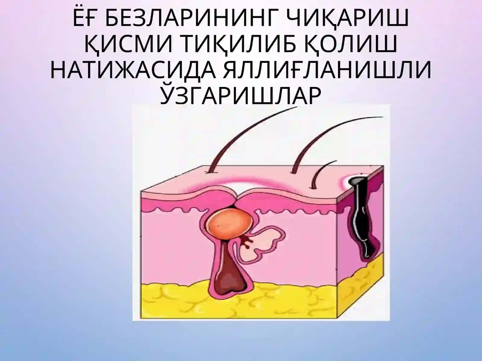 ХУСУНБУЗАР (УГРИ) 4