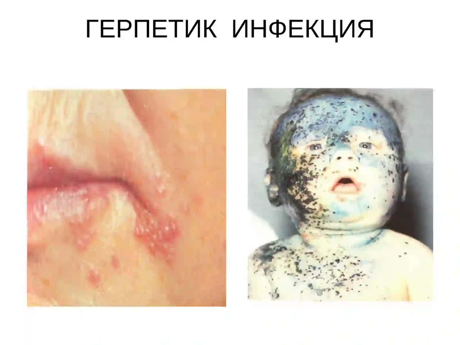 СУВЧЕЧАК ВА УЧУҚЛАР 4