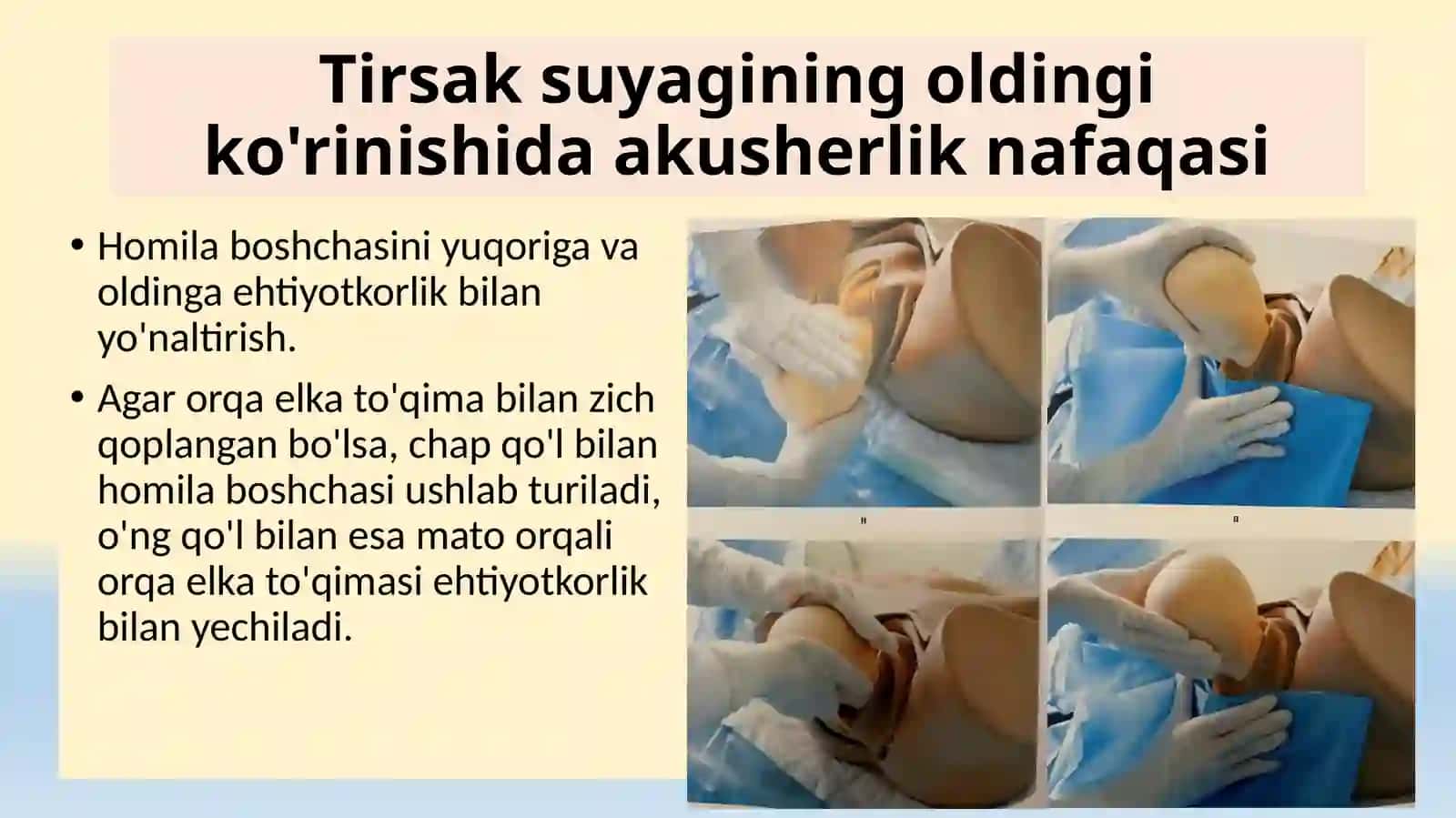 Fiziologik tug'ruqni boshqarish va yordam ko'rsatish (2-qism) 4