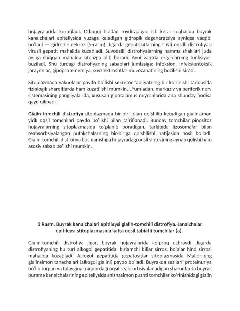 Distrofiya 4