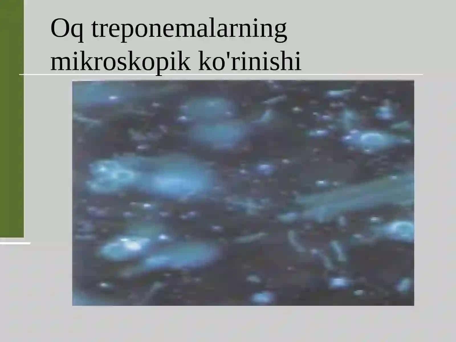 Teri-tanosil kasalliklari kursi 4