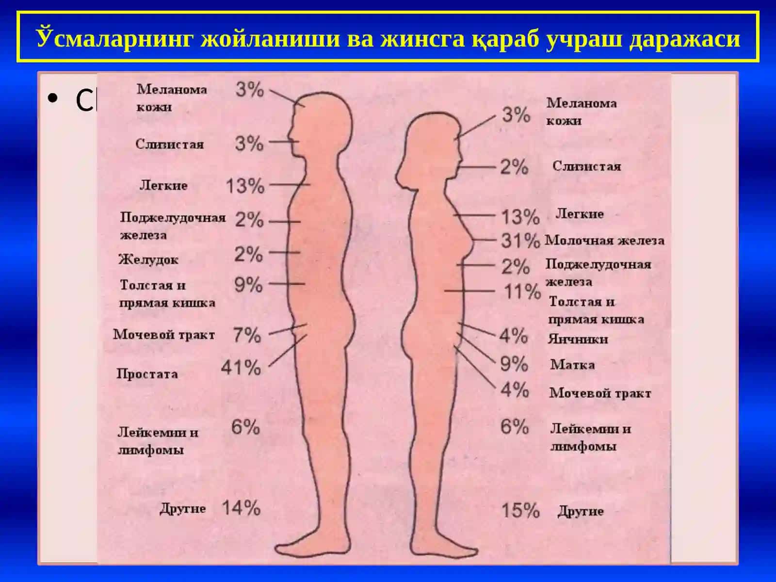 ПАТОЛОГИК АНАТОМИЯ "Ўсмалар, умумий тушинчалар. Эпителий ўсмалари" 4