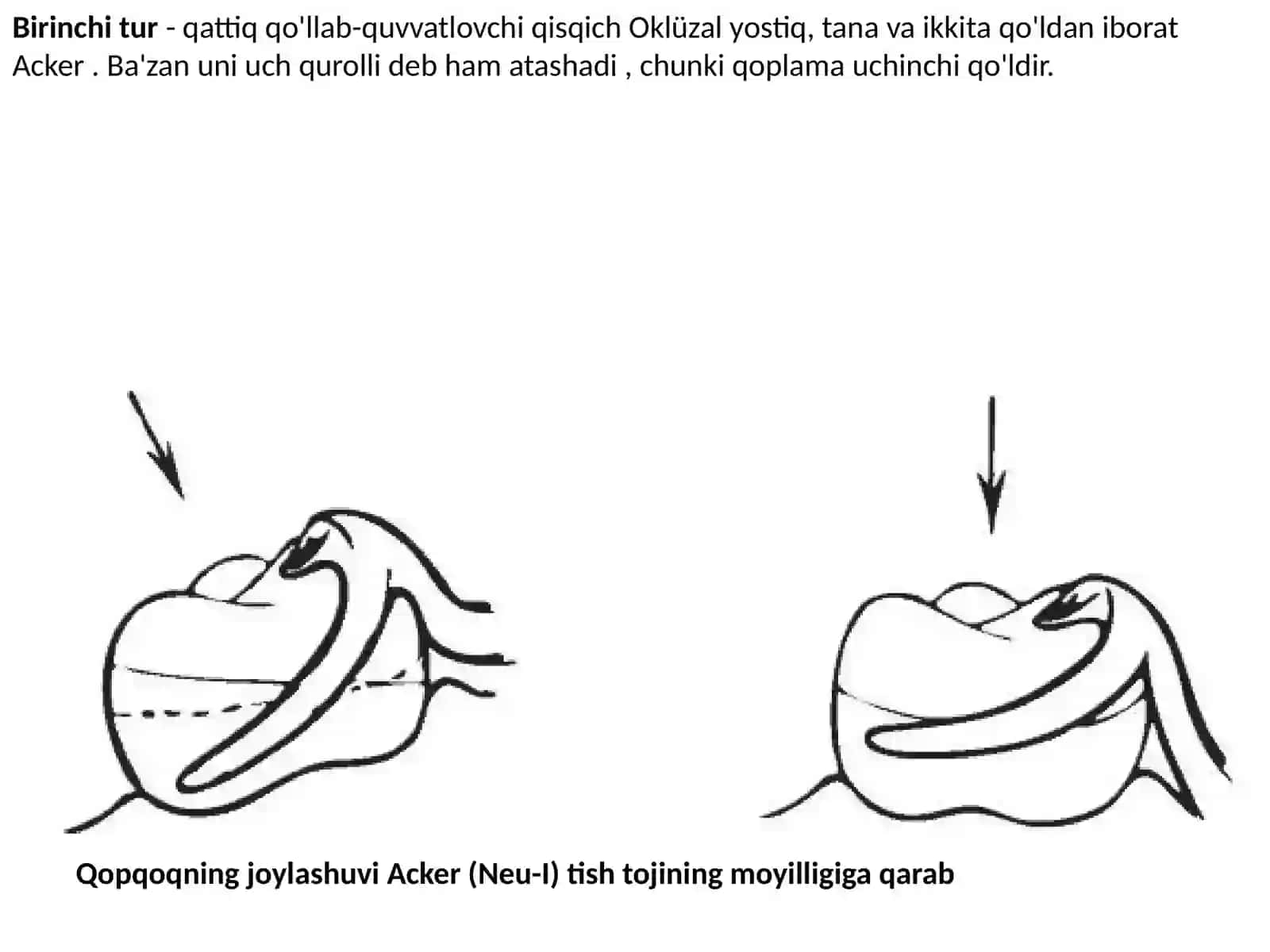 Ney klammer tizimi 4