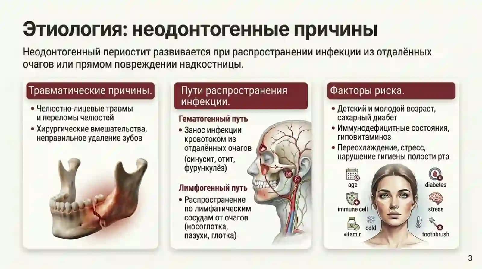 Периостит челюстий 4