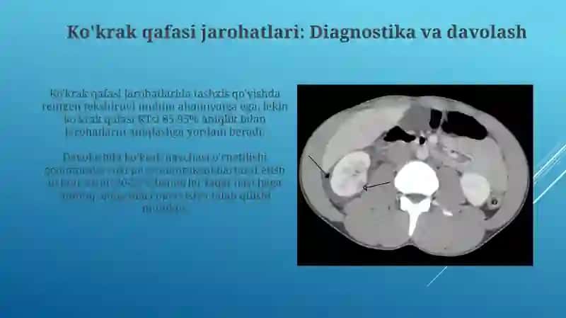 Ko’krak qafasi, qorin bo’shlig’i va kichik tos azolari travmasi. Politravmada tekshirish taktikasi 4