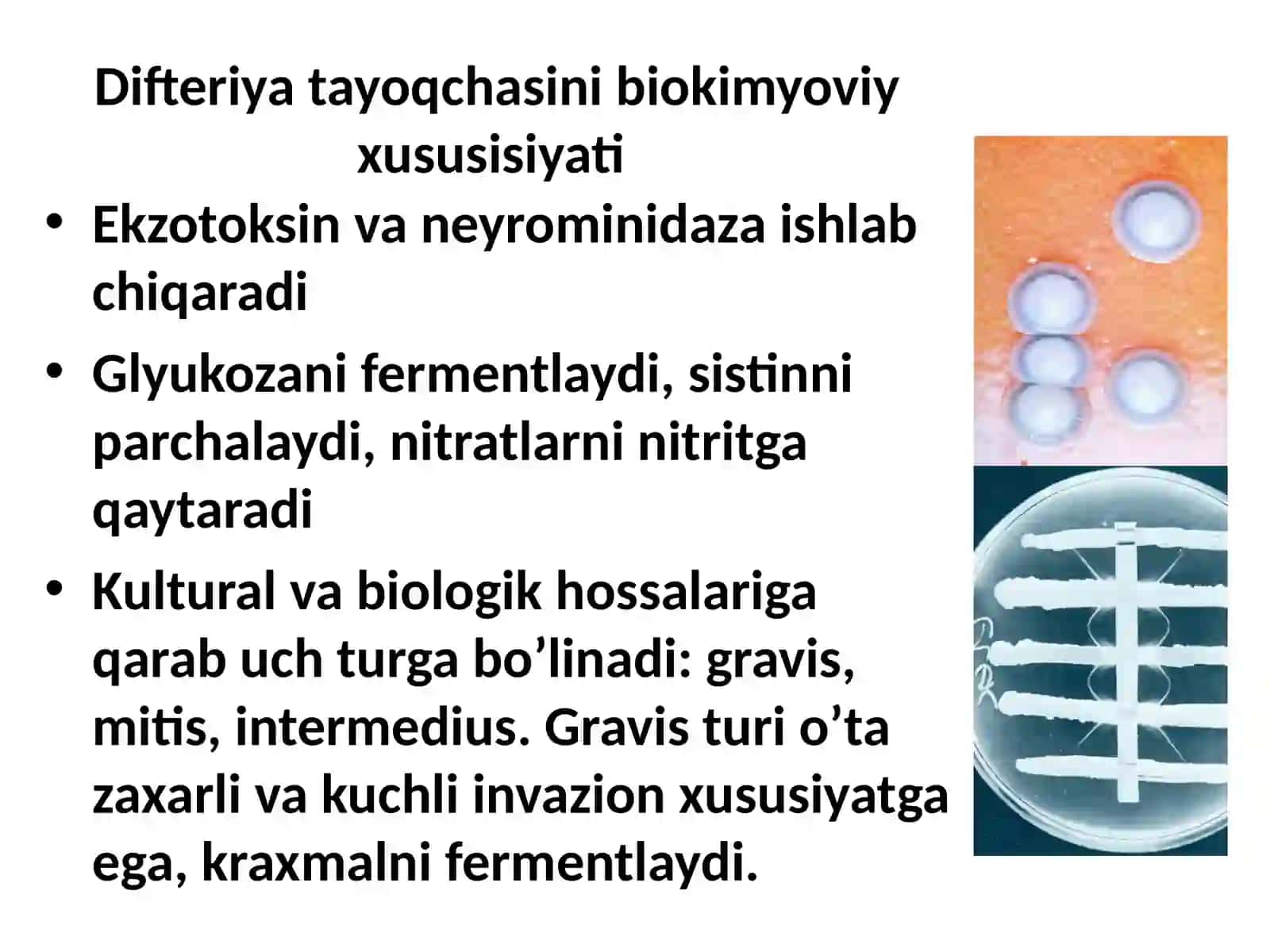 BOLALAR INFEKSIYASI. BO'G'MA. SKARLATINA. QIZAMIQ PATOMORFOLOGIYASI 4