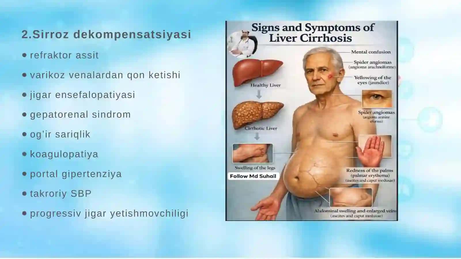 jigar transplantatsiyasi 4