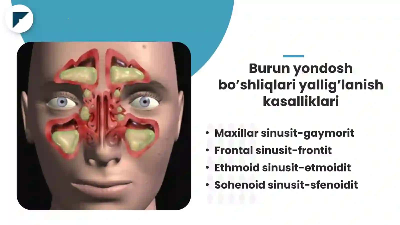 Burun yondosh bo'shliqlari kasalliklarining nur tashxisi 4