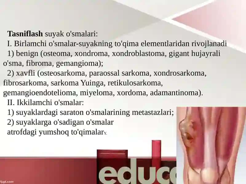 Harakat-tayanchtizimidaog'riqlisindromi.Harakat-tayanchtizimidao'smakasalliklari 4