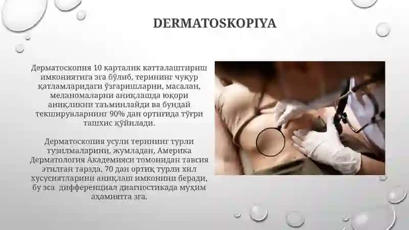 Nevuslar 4