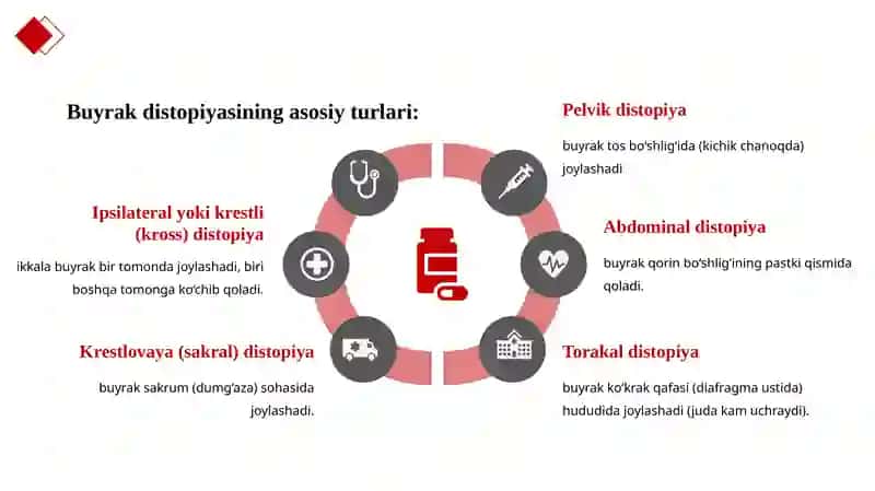 Buyraklarning tug'madi stopiyasi 4