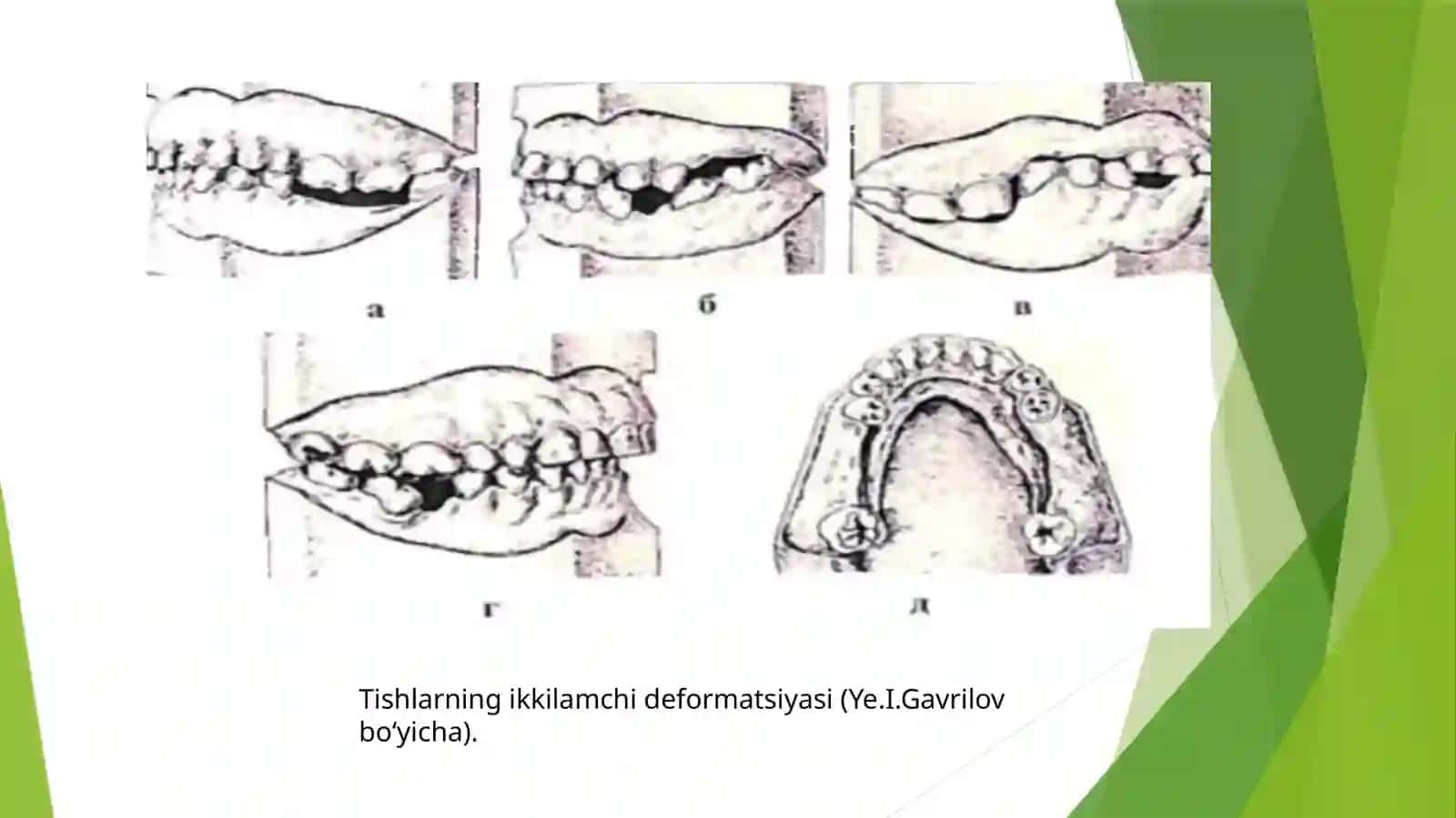 Kattalarda ortodontik davolash tadbirlari. Tish qatorining ikkilamchi deformatsiyalari, parodont kas 4