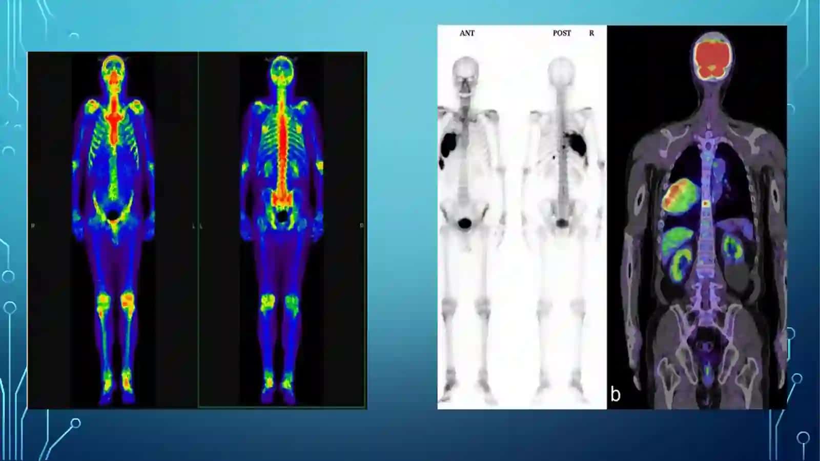 RADIATSION Terapevtik texnika. Nur terapiyasi. Yadro tibbiyoti va tibbiy radiologiya 4
